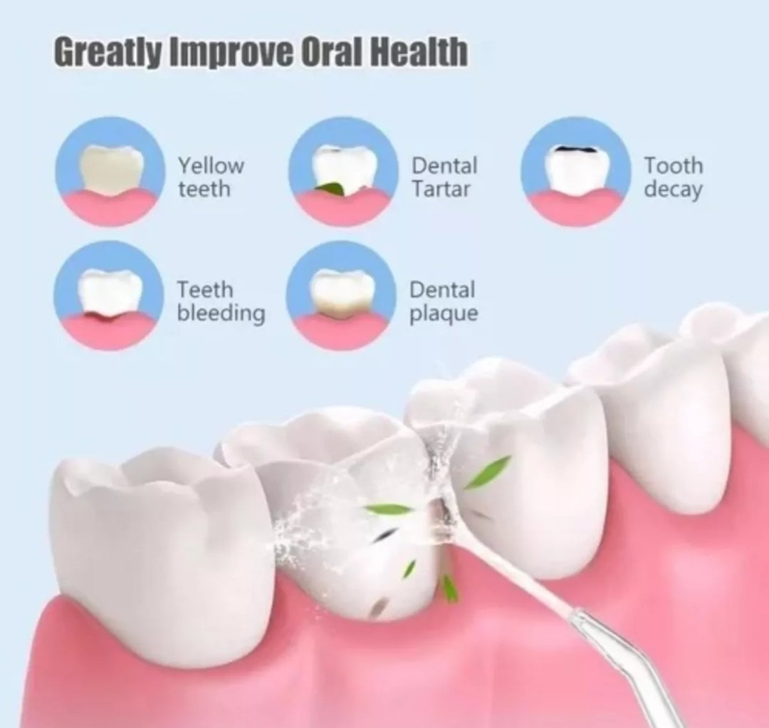 Irrigador Bucal Portátil Limpieza  y Salud Dental  Recargable